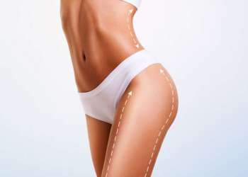 Clínicas de liposucción en Turquía - Mujer con un boceto de las nuevas curvaturas en su figura, luego de realizarse una cirugía de liposucción