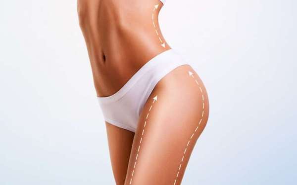 Clínicas de liposucción en Turquía - Mujer con un boceto de las nuevas curvaturas en su figura, luego de realizarse una cirugía de liposucción