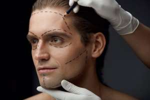 Clínicas de estética - imagen de la cara de un hombre donde el especialista en medicina estética esta dibujando el diseño de una cirugía reconstructiva