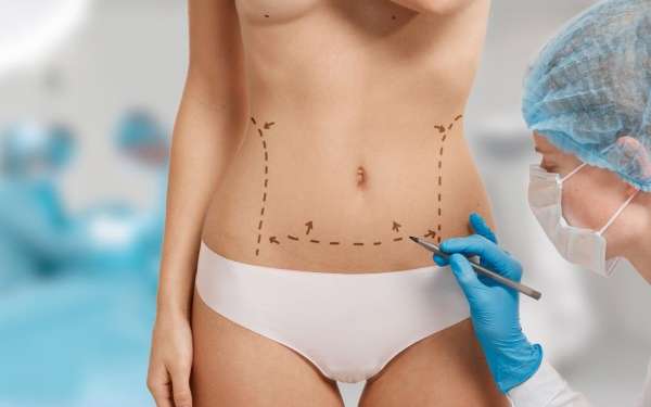 clínicas de abdominoplastia en Bilbao - mujer en la consulta de la cirujana plástica diseñando el tratamiento de la abdominoplastia