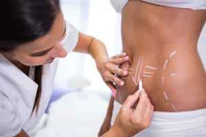 abdominoplastia en Zaragoza