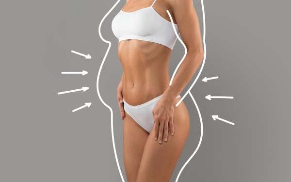 Liposucción en Zaragoza - Imagen de una mujer con una silueta más delgada, como referencia a lo que se puede conseguir con la liposucción