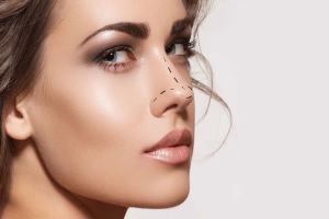 Rinoplastia en Zaragoza