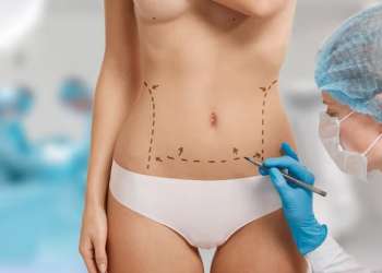 abdominoplastia en zaragoza