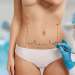 abdominoplastia en zaragoza