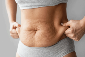 Abdominoplastia en Zaragoza