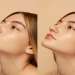 Rinoplastia en Murcia - imagen del antes y después de la rinoplastia de una mujer joven