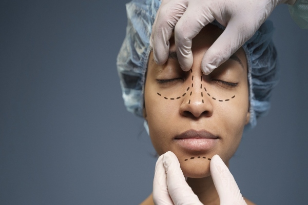 clínicas de rinoplastia en Las Palmas - mujer en la consulta del cirujano plástico recibiendo las explicaciones de como va a realizarse la rinoplastia mientras el cirujano dibuja las líneas de la cirugía