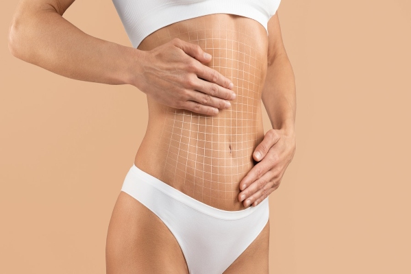 Mujer en ropa interior coloca sus manos sobre un trazo de secciones en la pared abdominal para calcular la cantidad de piel y de grasa que se removerá en un procedimiento quirúrgico de carácter estético