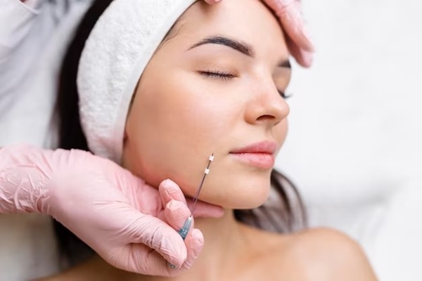 Médico especialista realizando un tratamiento con hilos tensores en el rostro de una mujer, para rejuvenecer su piel y reafirmar los pómulos