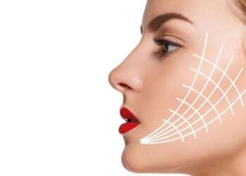Clínicas de hilos tensores - Imagen referencial del tratamiento remallado de hilos tensores en el rostro de una mujer, lo cual permite rejuvenecer la piel