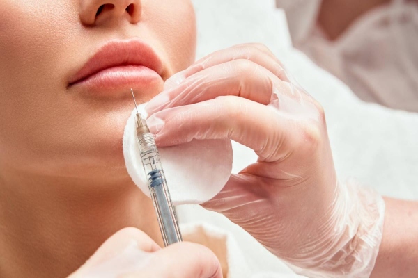 Dermatóloga sostiene un jeringa con ácido hialurónico para infiltrar los labios de una paciente en diversos puntos