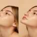 clínicas de rinoplastia en Palma de Mallorca - imagen del antes y después de la rinoplastia de una mujer joven