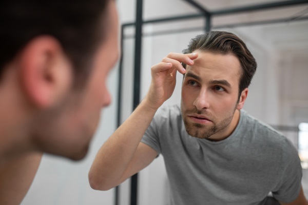 Duele el pelo - Hombre mirando su cabello frente al espejo, para descubrir la razón por la cual le duele el cuero cabelludo
