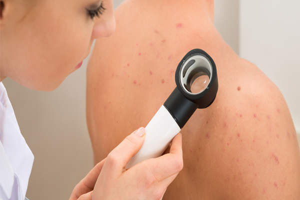 Foliculitis - Dermatóloga examina con detenimiento la piel de paciente con folículos inflamados en la espalda
