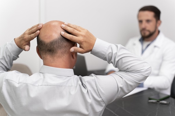 Paciente en una consulta con el tricólogo, para conocer si es candidato a un trasplante de cabello