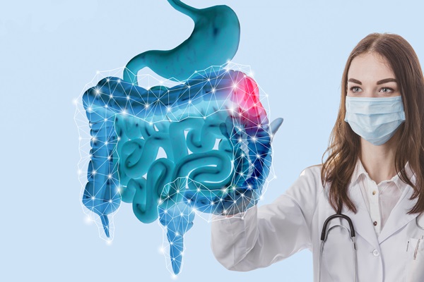 Doctora señalando la ubicación en el colon donde se suele formar la inflamación, la cual origina la diverticulitis