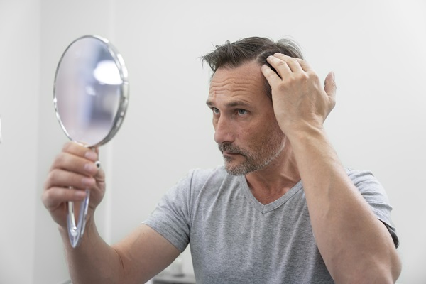 Hombre observando en el espejo que todavía no se caen las costras luego del implante de cabello
