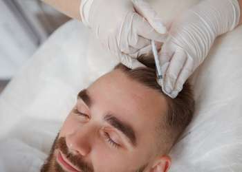 Injerto capilar definitivo - Hombre recibiendo un tratamiento capilar luego del injerto de cabello en la mejor clínica injerto capilar Madrid