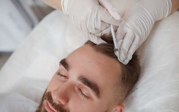 Injerto capilar definitivo - Hombre recibiendo un tratamiento capilar luego del injerto de cabello en la mejor clínica injerto capilar Madrid