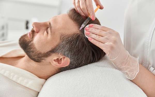 Mesoterapia capilar tratamiento - Dermatóloga inyecta un cóctel de vitaminas para estimular el crecimiento del cabello en un hombre