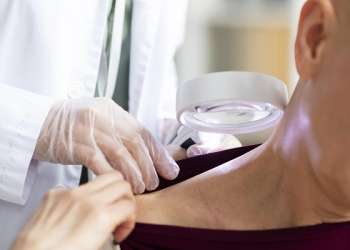 Psoriasis capilar, causas, síntomas y tratamiento - dermatólogo revisando la piel de los hombros y cuello de una paciente