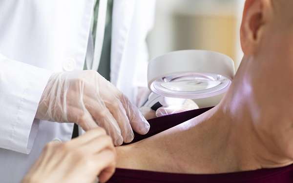 Psoriasis capilar, causas, síntomas y tratamiento - dermatólogo revisando la piel de los hombros y cuello de una paciente