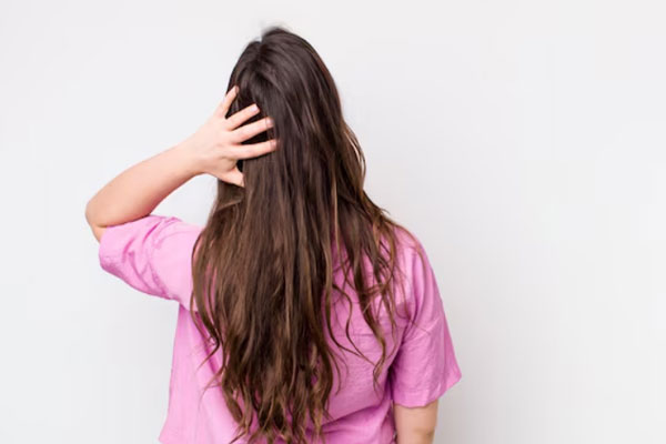 La calvicie y el pelo graso - Mujer de cabello graso de espalda se rasca la cabeza por afecciones capilares