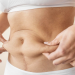 Mujer busca tratamientos efectivos para eliminar las cartucheras del abdomen