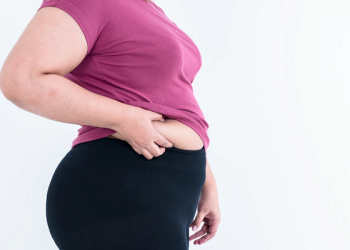 Mujer con exceso de grasa corporal aprieta la piel sobrante de su abdomen