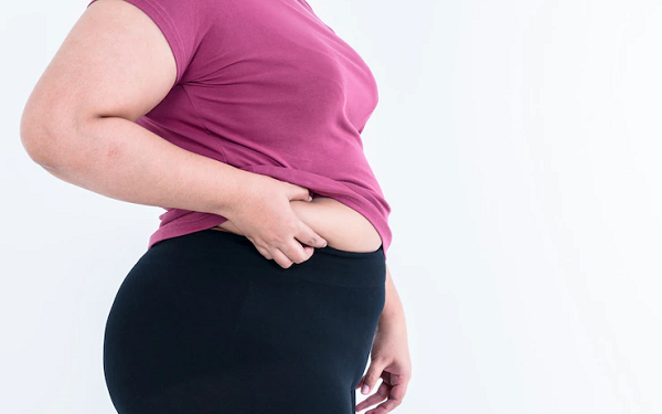 Mujer con exceso de grasa corporal aprieta la piel sobrante de su abdomen