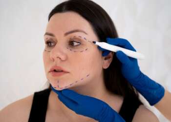 Clínica de cirugía estética - Médico profesional realizando el boceto de la cirugía estética en el rostro de una mujer joven
