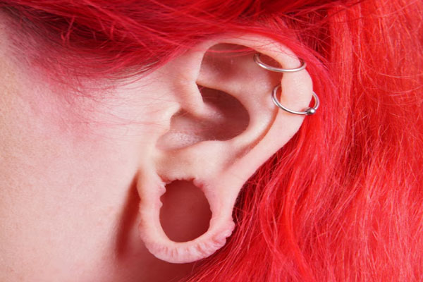 Plano detalle de un lóbulo rasgado por el uso de un expansor de oreja