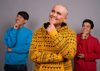 alopecia jovenes