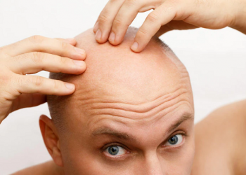 injerto pelo cicatrices