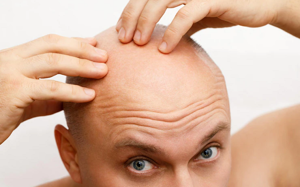 injerto pelo cicatrices