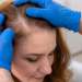 diagnosticar alopecia