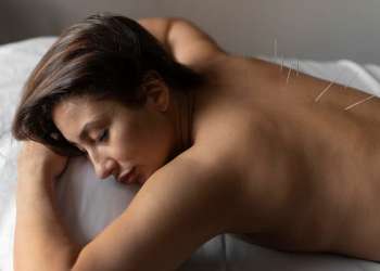 acupuntura