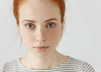 pecas en la piel