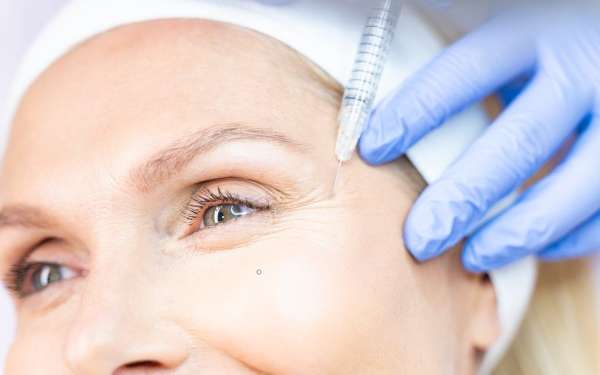 hilos tensores y bótox