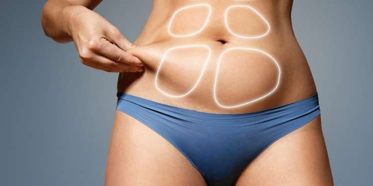 Las 3 mejores clínicas de intralipoterapia en Madrid