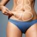 Las 3 mejores clínicas de intralipoterapia en Madrid