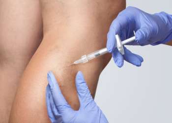 Las 3 mejores clínicas de ecleroterapia en Madrid