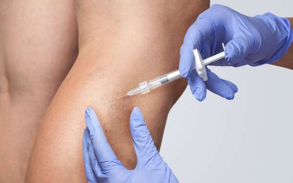 Las 3 mejores clínicas de ecleroterapia en Madrid