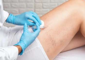 Las 3 mejores clínicas de escleroterapia en Barcelona