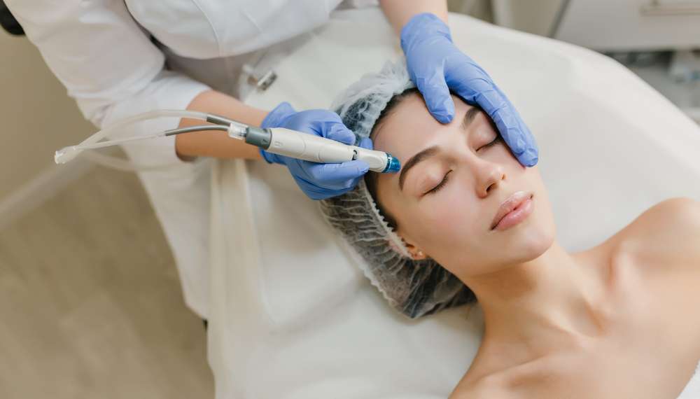 clínicas de nanopeeling en España