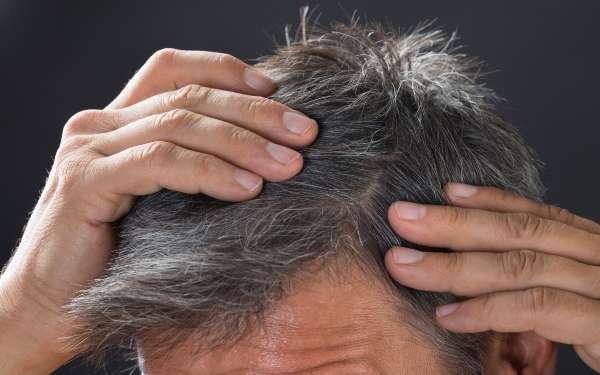 ¿Aumentar la melanina del cabello es posible?