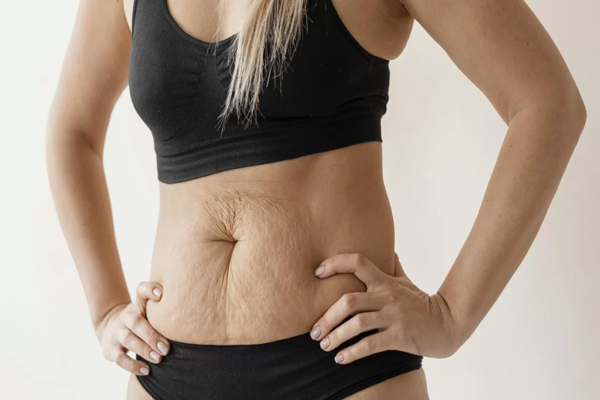 Tipos de celulitis