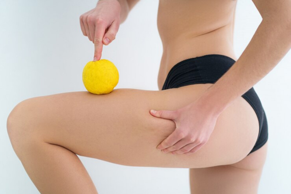 Tipos de celulitis
