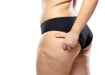 Tipos de celulitis